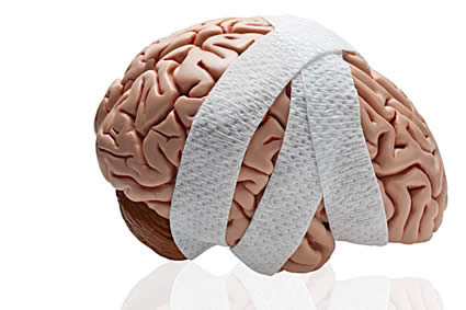Brainnovation Brain Training for Traumatic Bbrain Injuries Victims
